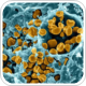 Researchers reveal new molecular mechanisms that resist visceral leishmaniasis