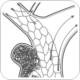 SIR, Society for Vascular Surgery partner on IVC filter study