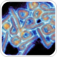 Update on suspected Acute Haemorrhagic Fever in Republic of the Congo