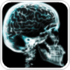 Researchers discover how LRRK2 mutations in familial Parkinson's damage brain cells