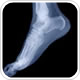 Research reveals vitamin C does not reduce urate levels in gout patients