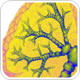 Researchers develop predictive biomarker to identify cancer patients who may respond to autophagy inhibitors