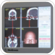 Study shows brachytherapy is underused in the UK