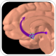 IL-13 receptor system could play a major role in Parkinson's