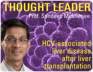HCV-associated  liver disease  after liver  transplantation