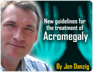 New guidelines for the treatment of acromegaly, a serious growth hormone disorder