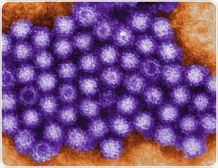 Norovirus