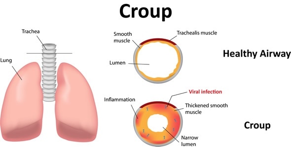 download insulin resistance and