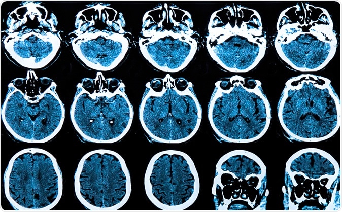 Health and Medical news: Image Credit: Photoprofi30 / Shutterstock