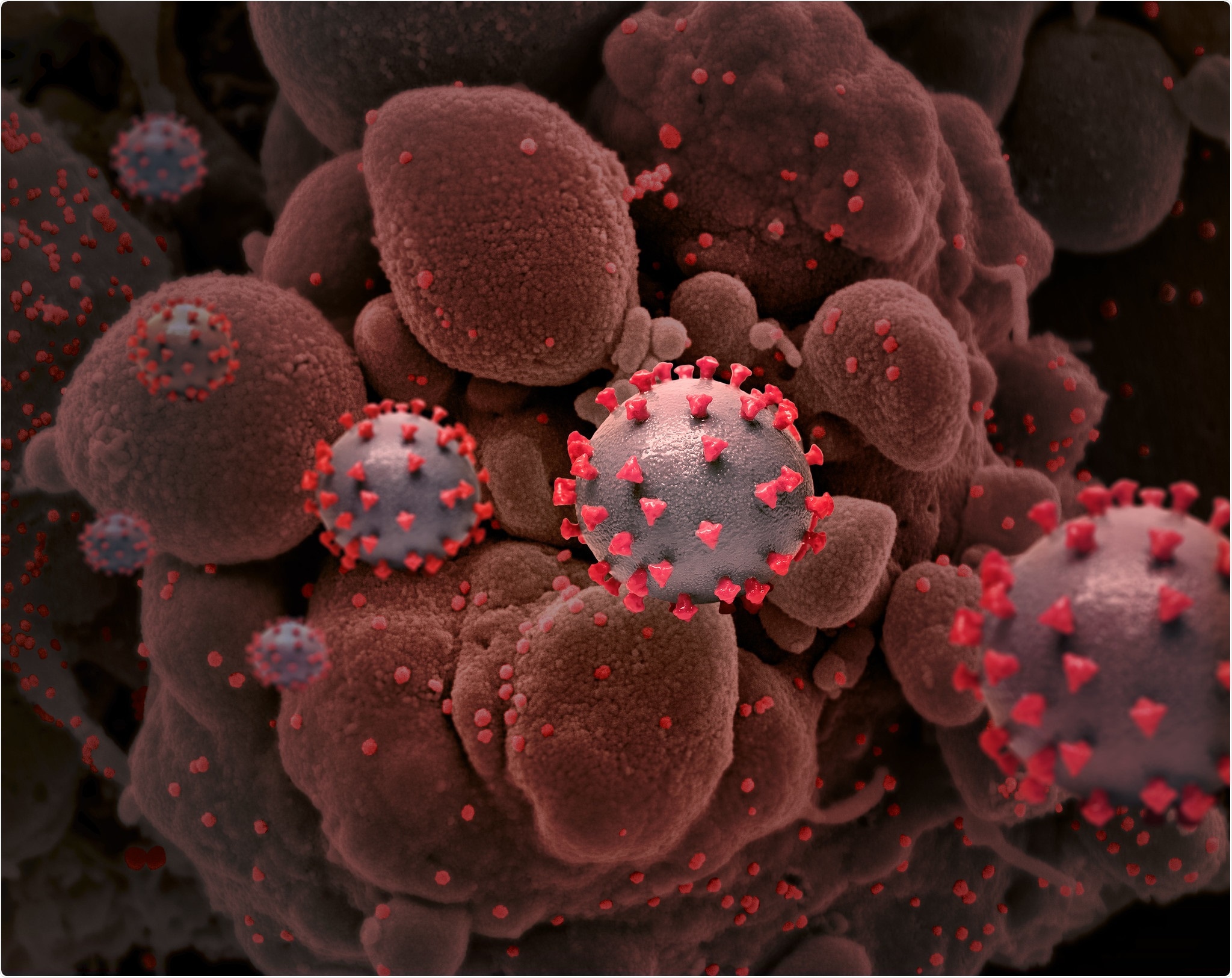 Novel Coronavirus SARS-CoV-2 Creative rendition of SARS-COV-2 virus particles. Note: not to scale. Credit: NIAID