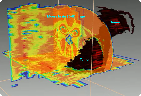 3D mouse brain tumour