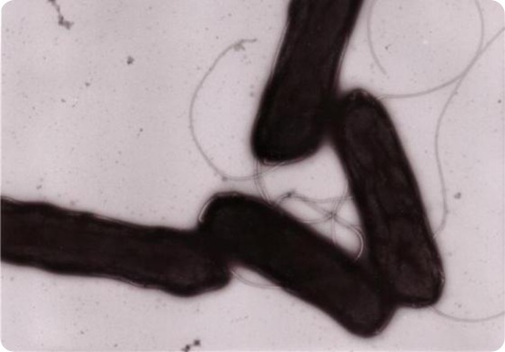 Yersinia pestis