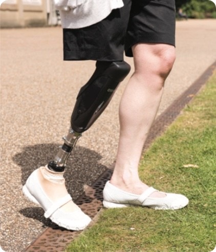 Advances in prosthetic knee technology - News-Medical.net