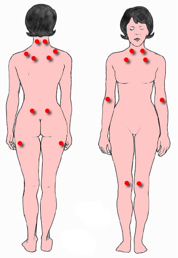 What Is Rheumatology