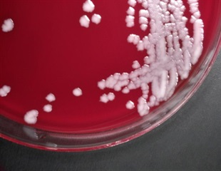 Solid formulations of the recombinant anthrax vaccine: an interview with Dr Mark Carnegie-Brown, CEO, Glide Pharma