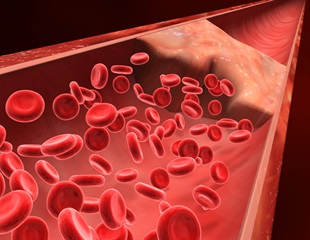 Tranexamic acid modestly reduces bleeding after cesarean delivery in women