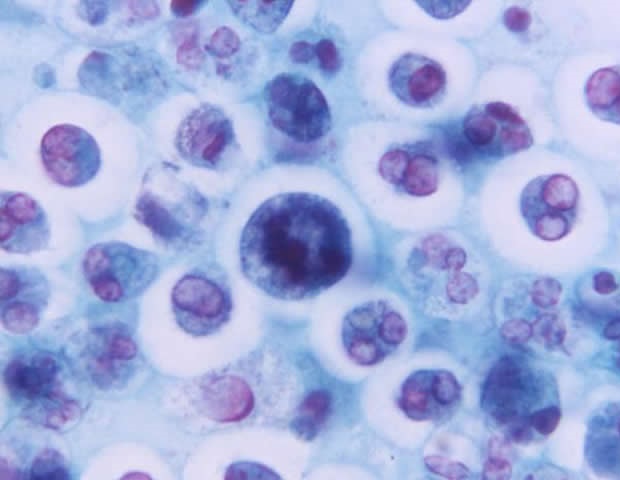 Skin barrier monitoring predicts necrosis after skin flap surgery