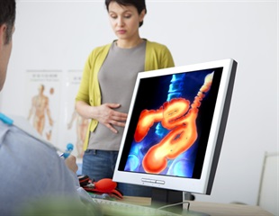 Advances in the surgical management of gastroschisis