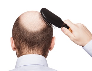 New 3D mapping technology reveals how hair follicles form over time