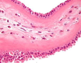 Study maps how macrophages age across different body tissues