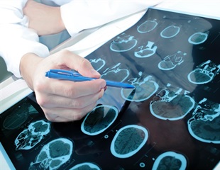 3D DNA organization in rare immune cells can explain Crohn's disease risk