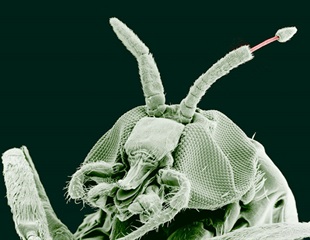 Researchers receive $5 million to study two types of parasitic infection
