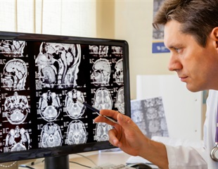 Women in high-deprivation areas face barriers to digital breast tomosynthesis screening