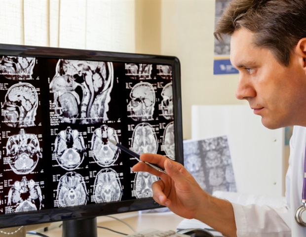 New open-source algorithm accelerates complex medical image analysis