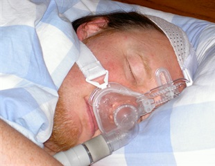 Hypothyroidism linked to higher risk of obstructive sleep apnea