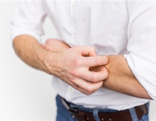 Common clinical problem, Rosacea