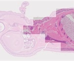 Olympus cellSens provides automatic panoramic images on any manual microscope