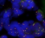 OGT introduces three new Cytocell Aquarius FISH probes