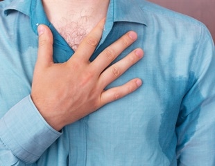 Excessive sweating could be hyperhidrosis that often goes undiagnosed