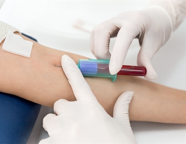 Blood biomarkers predict risk of multimorbidity in older adults