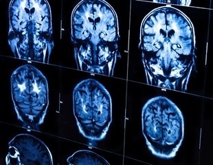 ZEISS VersaXRM 5 Insight accelerates hybrid 3D X-ray imaging