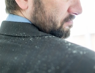 Does dandruff cause psychological distress? An interview with Dr Anjali Mahto