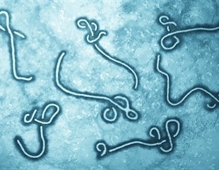 Study uncovers key structure in fatal Borna disease virus 1