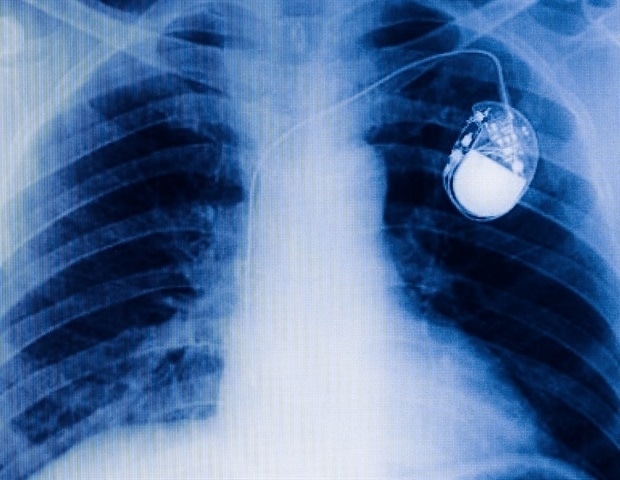 ZEISS VersaXRM 5 Insight accelerates hybrid 3D X-ray imaging