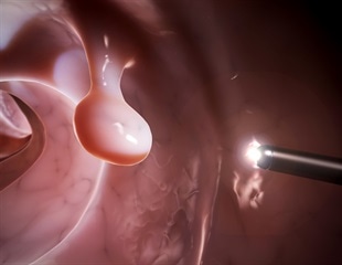 Exploring the role of repeat esophagogastroduodenoscopy and colonoscopy in diagnosing GI bleeding