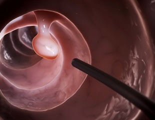 Exploring the role of repeat esophagogastroduodenoscopy and colonoscopy in diagnosing GI bleeding