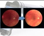 Volk iNview portable fundus camera now compatible with iPhone SE