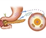 FDA approves automated insulin delivery device for type 1 diabetes