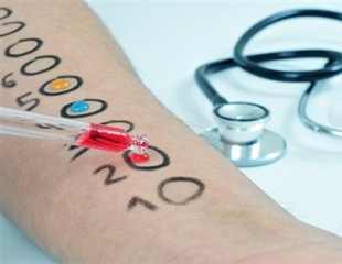 That’s a lot of scratch: The $48,329 allergy test