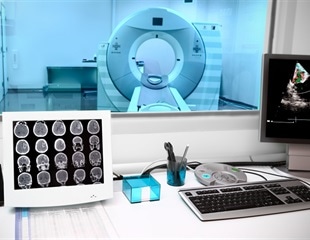 Huntsman Cancer Institute advances interventional radiology with new angio CT suite