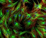 New procedure standard/practice guideline released for fibroblast activation protein PET