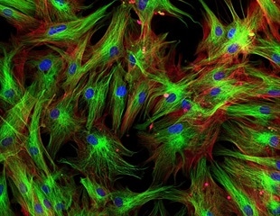 Researchers uncover molecular pathway driving craniosynostosis