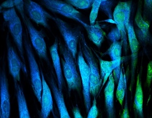 Machine learning identifies natural compound to treat lung disease
