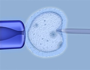 Optically invisible culture dishes improve embryo imaging in IVF