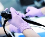 New guideline on use of endoscopic eradication therapy in Barrett's esophagus