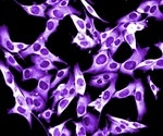 New technique could lead to better and faster diagnoses of life-threatening melanomas